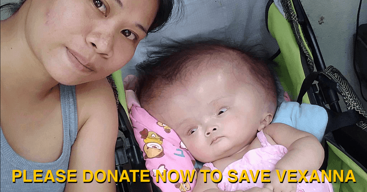 Help for Vexanna