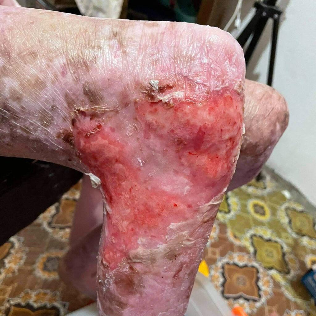 Joyce vive con un dolor que ningún niño debería soportar