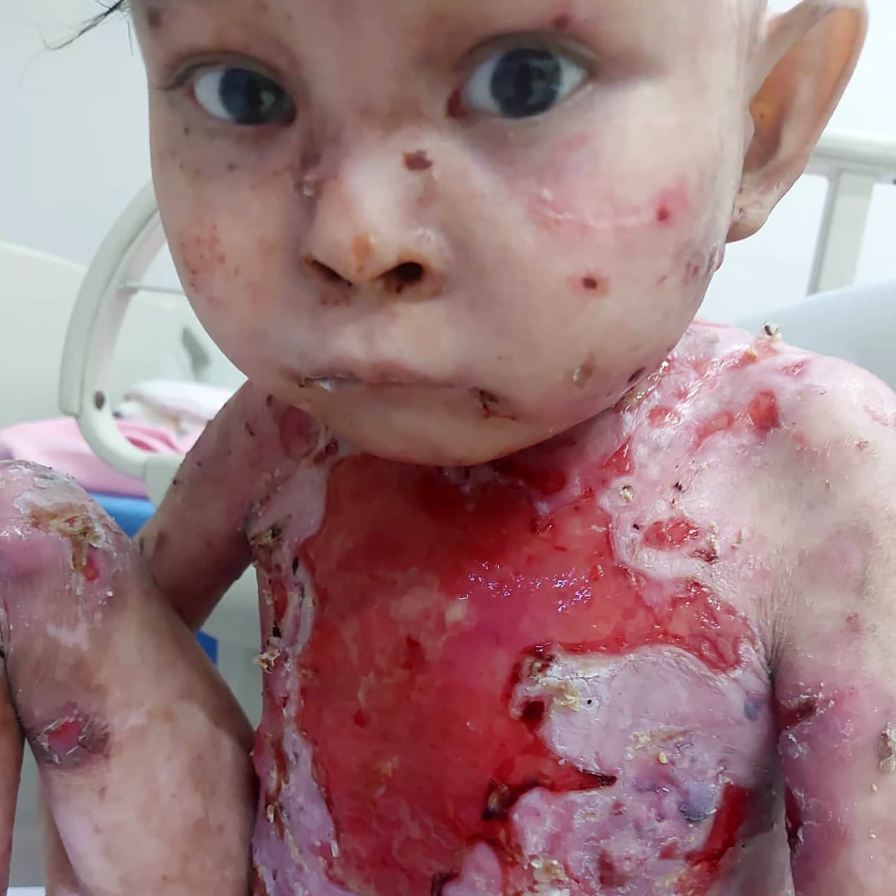 Help for Mirachael