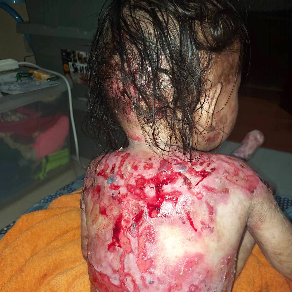 Help for Mirachael
