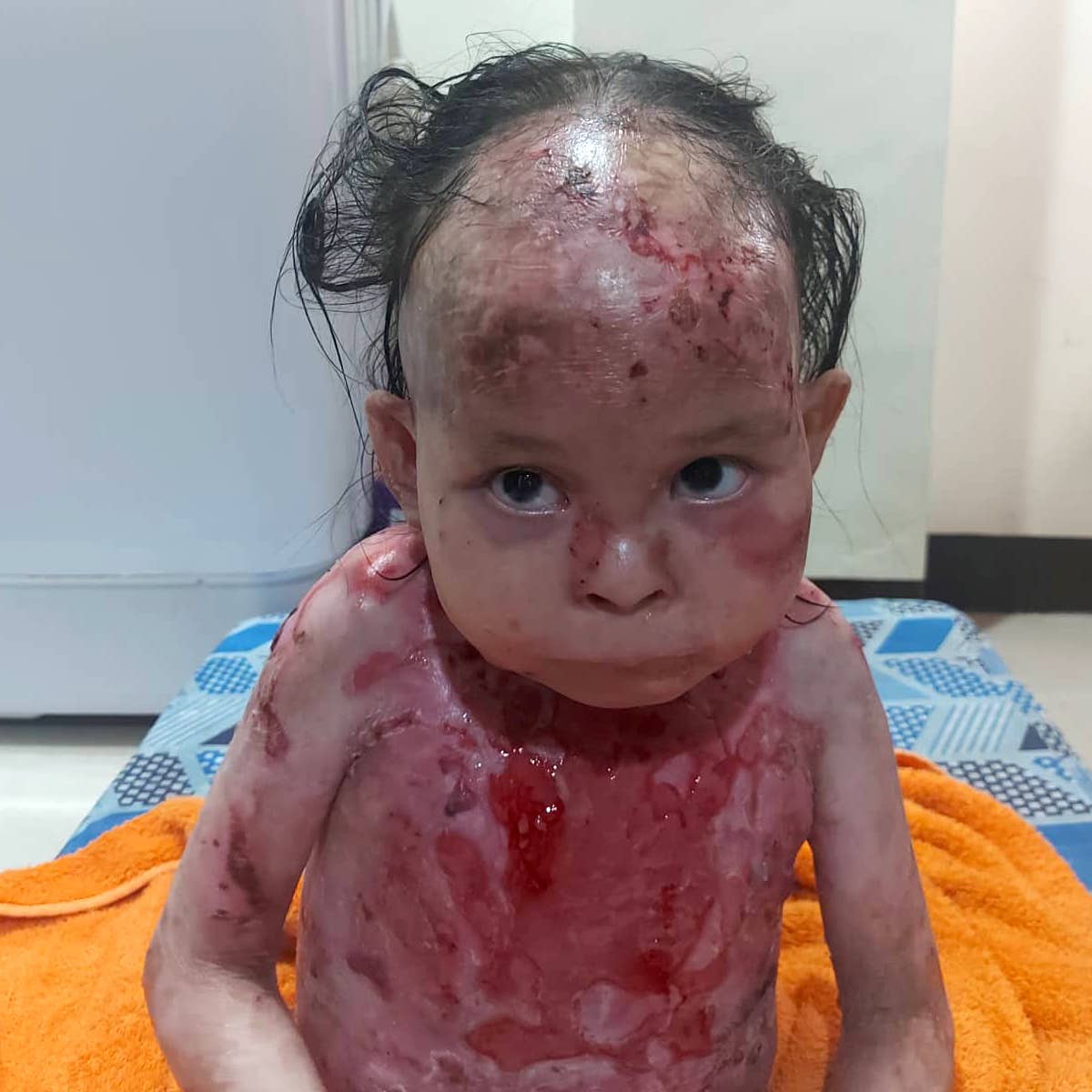 Help for Mirachael