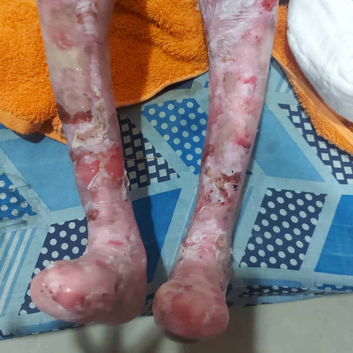 Help for Mirachael