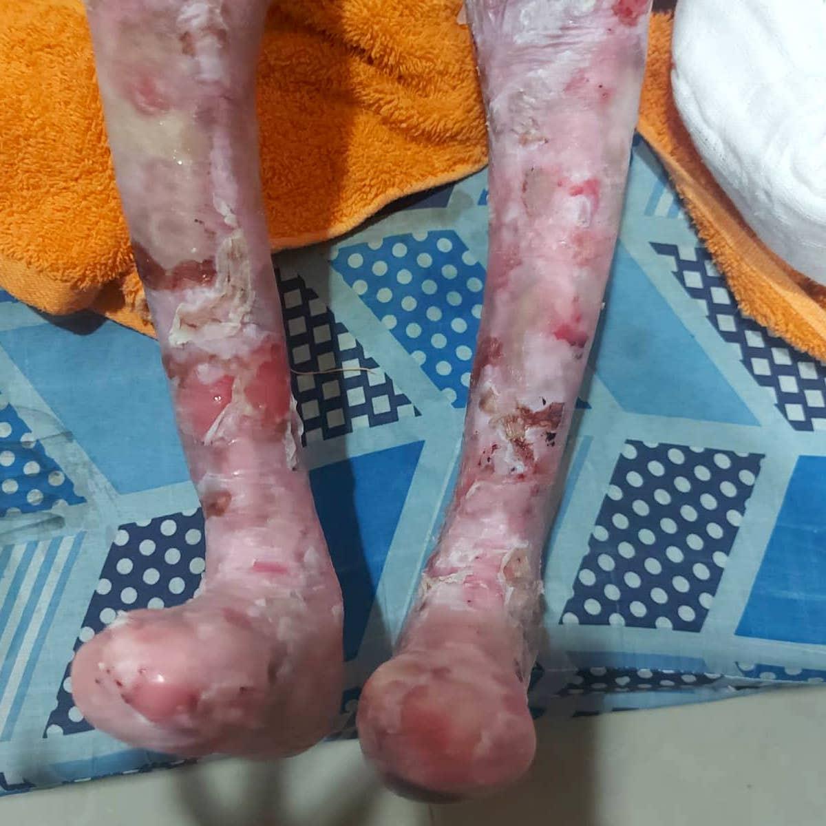 Mirachael vive con un dolor que ningún niño debería soportar