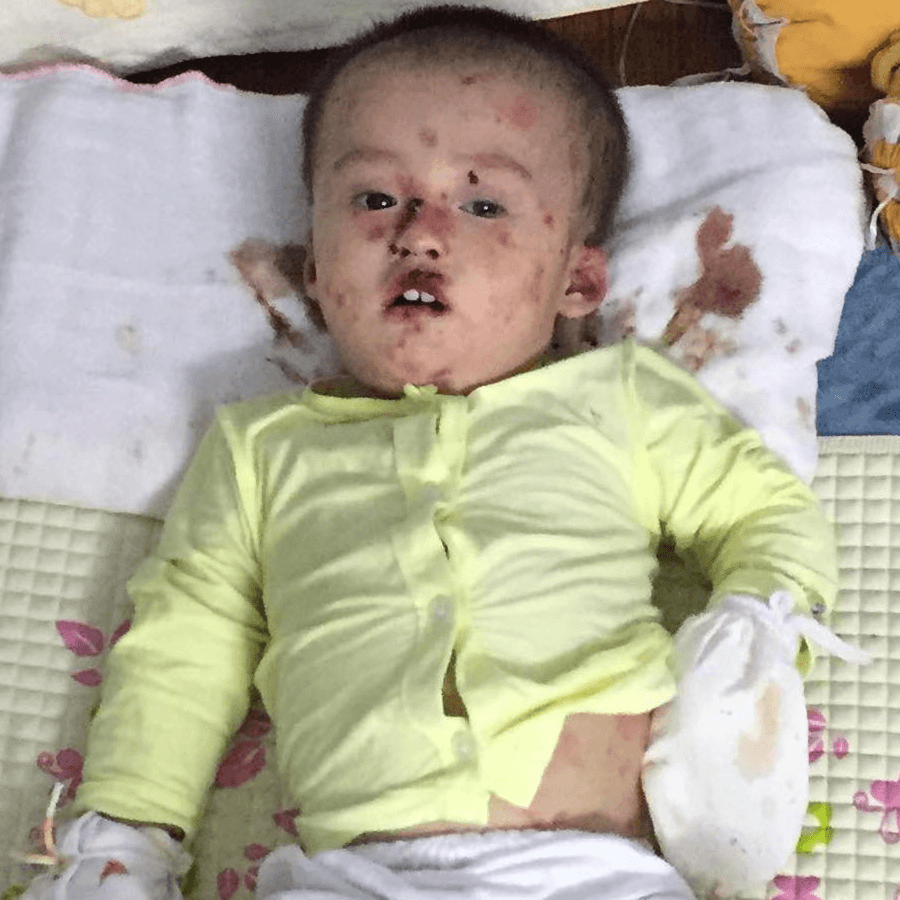 John vive con un dolor que ningún niño debería soportar