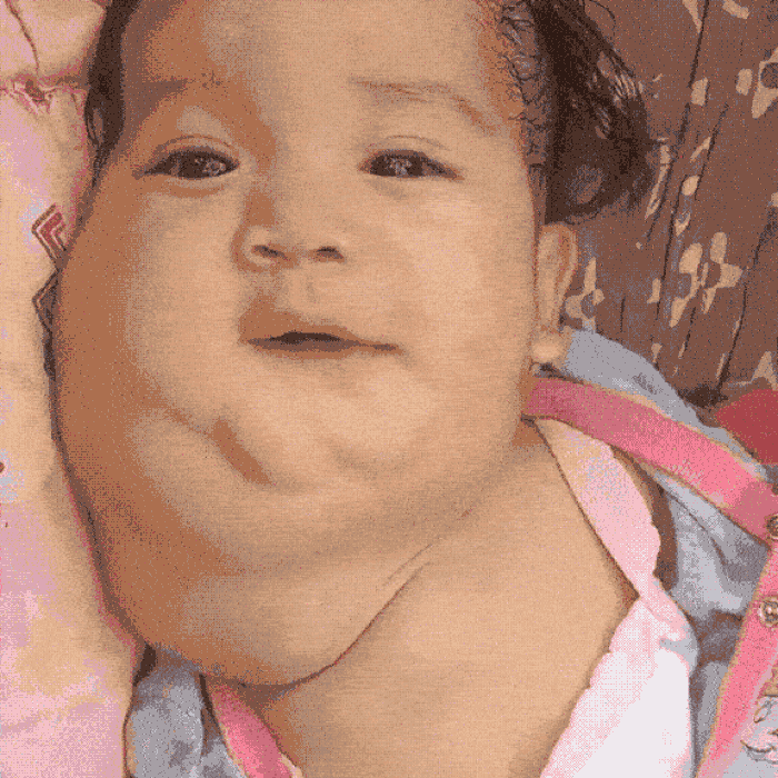 Isabella vive con un dolor que ningún niño debería soportar